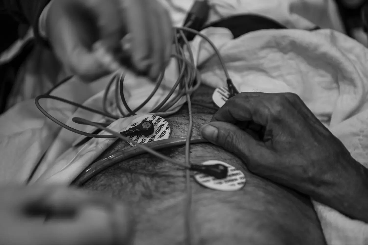 A black-and-white photograph of a man getting an EKG. Two hands attach wires to his skin.